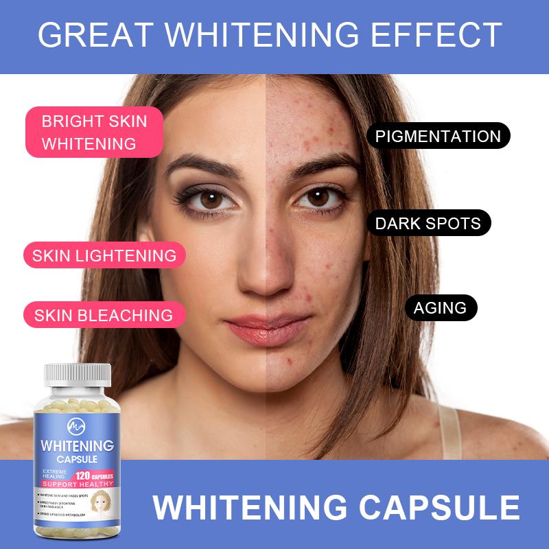 Minch Whitening Capsules Glutathione Softgels Effective Skin Lightening Supplement Dark Spots Melasma Acne Scar Remover Hyperpigmentation Treatment Anti-Aging Antioxidant